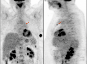 Case 2 (Image 1)