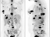 Case 4 (Image 1)