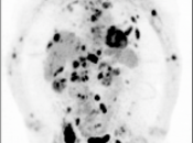 Case 8 (Image 1)