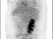 Case 2 (Image 1)