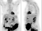 Case 6 (Image 1)