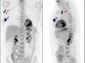 Case 7 (Image 1)