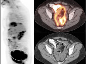 Case 8 (Image 1)