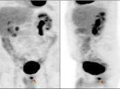 Case 2 (Image 1)