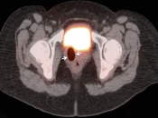 Case 1 (Image 1)