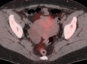 Case 4 (Image 1)