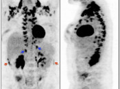 Figure 1 (Image 1) brown fat case 1