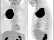 Case 2 (Image 1)