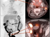 Case 4 (Image 1)