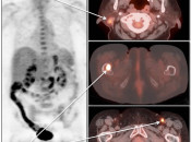 Case 5 (Image 1)