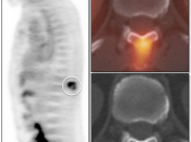 Case 4 (Image 1)