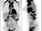 Figure 3 (Image 1) brown fat case 3