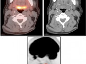 Case 1 (Image 1)