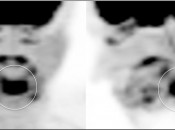 Case 2 (Image 1)