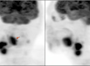 Case 3 (Image 1)