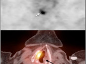 Case 2 (Image 1)