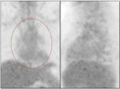 Case 1 (Image 1)