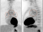 Case 2 (Image 1)