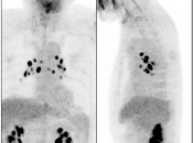 Case 3 (Image 1)