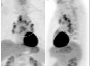 Case 4 (Image 1)