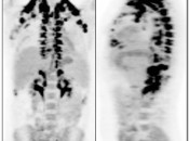 Figure 4 (Image 1) brown fat case 4