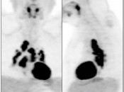 Case 5 (Image 1)