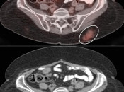 Case 1 (Image 1)