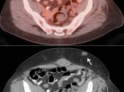 Case 2 (Image 1)
