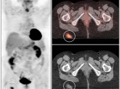 Case 3 (Image 1)