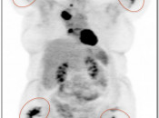 Case 4 (Image 1)