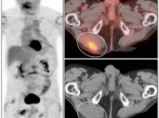 Case 5 (Image 1)