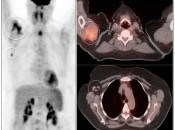 Case 7 (Image 1)