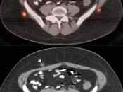 Case 8 (Image 1)