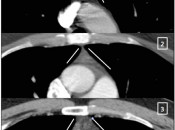 Case 1 (Image 1)