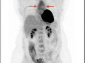 Case 2 (Image 1)
