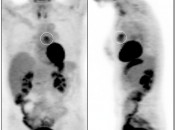 Case 4 (Image 1)