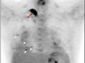 Case 1 (Image 1)