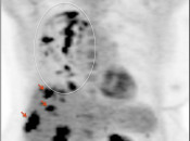 Case 2 (Image 1)