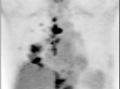 Case 3 (Image 1)
