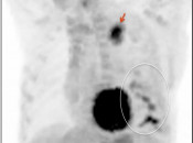 Case 4 (Image 1)