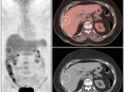 Case 2 (Image 1)