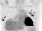 Case 5 (Image 1)