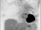 Case 6 (Image 1)