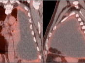 Case 7 (Image 1)