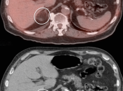 Case 1 (Image 1)