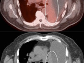 Case 5 (Image 1)