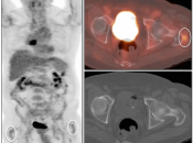 Case 4 (Image 1)