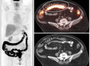 Figure 1 (Image 1) misregristration case 1