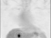 Case 1 (Image 1)