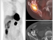 Figure 4 (Image 1) misregristration case 4